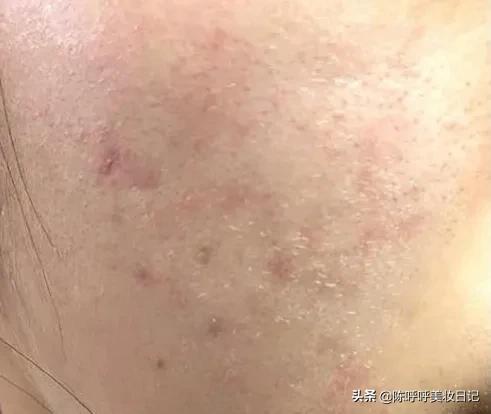 精华油的正确使用方法（精华液和精华油是同一种东西吗）