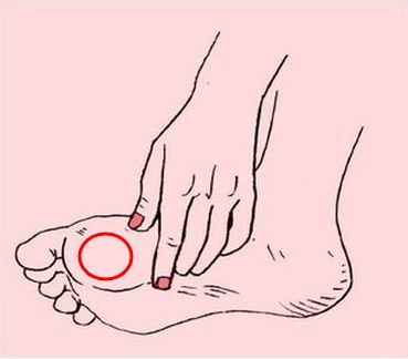 脚上磨出水泡要戳破吗（运动时如何避免水泡的产生）