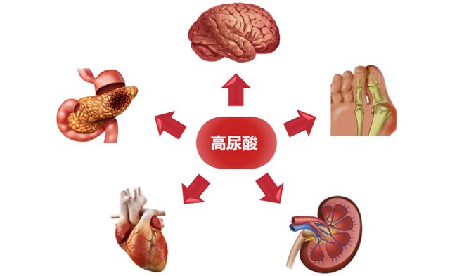 尿酸高者是否适宜献血（高尿酸患者是否可以进行献血）