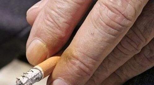手指烟熏黄清理方法（上烟熏导致手指发黄的清理方法）